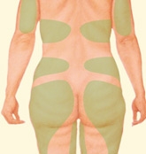 06_liposuction-01