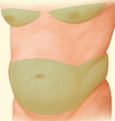 06_liposuction-03