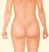 06_liposuction-05
