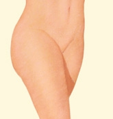 06_liposuction-06