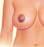 05_breast-red-circular-02