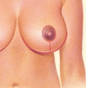 06_breast-red-vertical-02