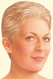 06_facelift-limited-02