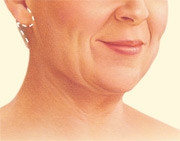 07_necklift-01