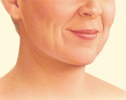 07_necklift-02
